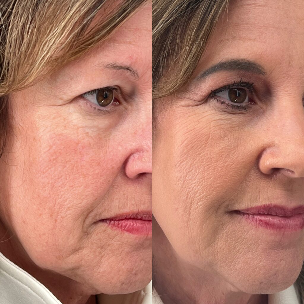 E339DCBF-FE3E-4066-9777-A59D53FFBB97