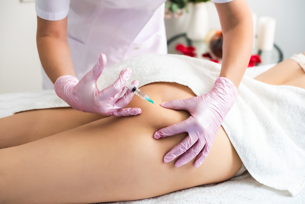 Close up of a patient receiving lipo dissolve injections to the back of her thighs to get rid of stubborn fat. Close up of a patient receiving lipo dissolve injections to the back of her thighs to get rid of stubborn fat.